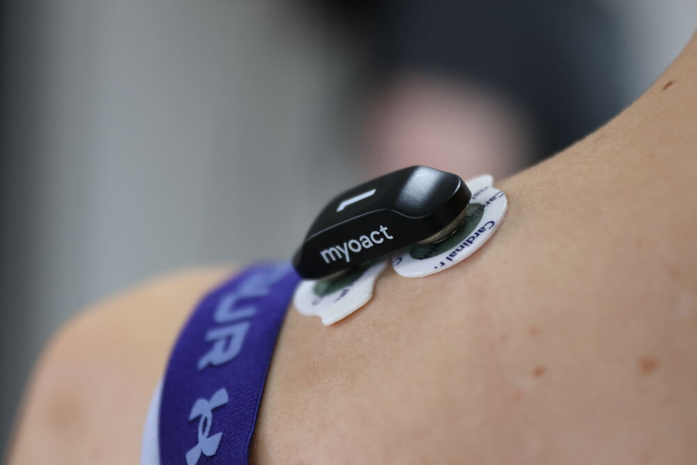 Myoact EMG-Sensor auf der Schulter